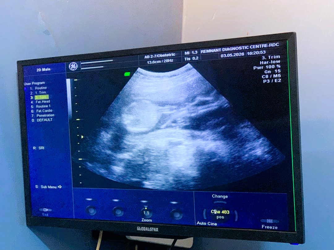 Ultrasound Suite