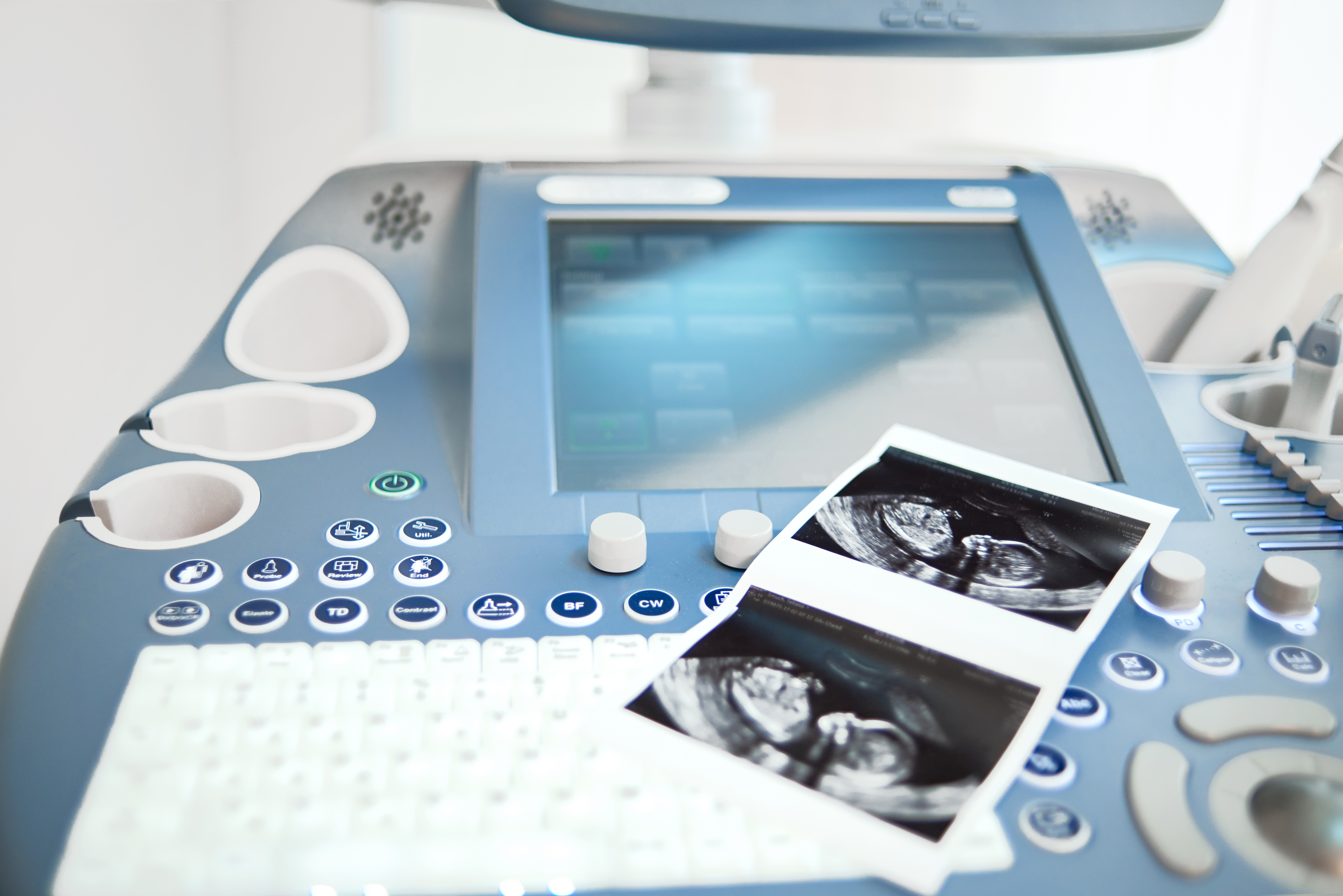 Ultrasound scan